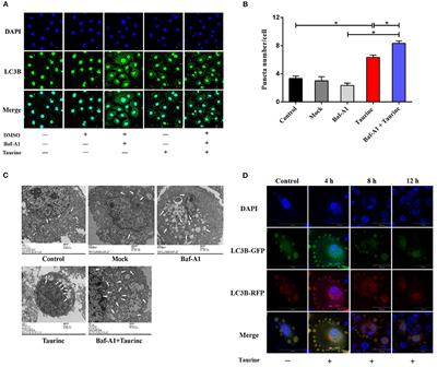 Taurine Alleviates Streptococcus uberis-Induced Inflammation by Activating Autophagy in Mammary Epithelial Cells